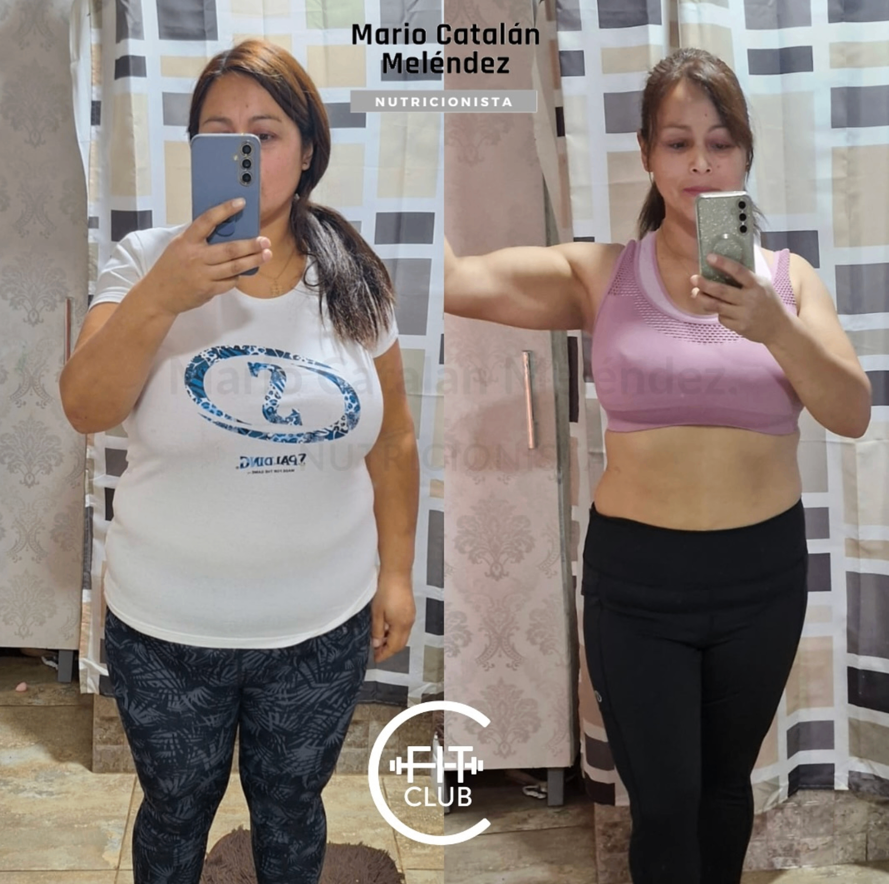 Transformación real de paciente 3