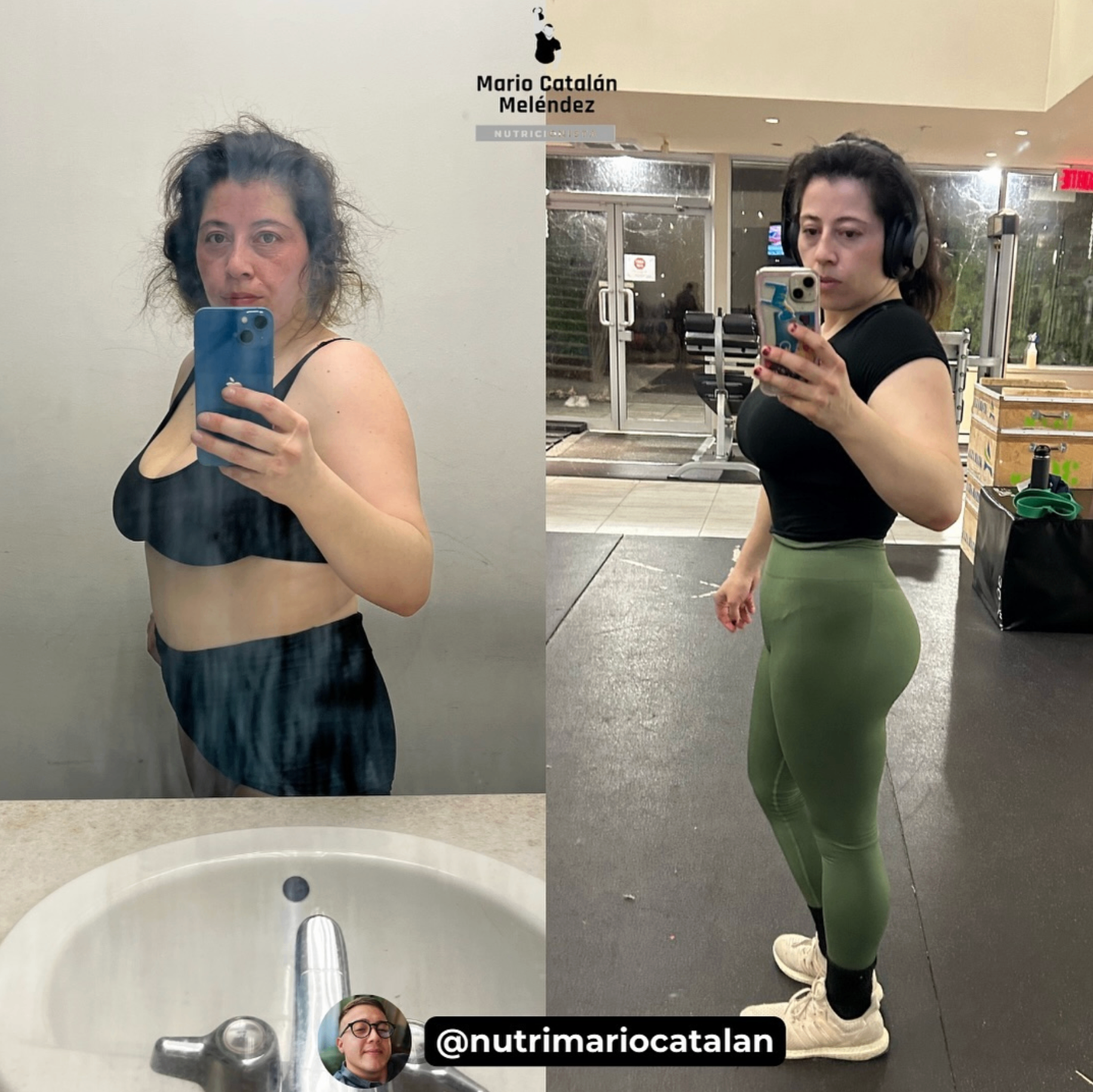 Transformación real de paciente 1